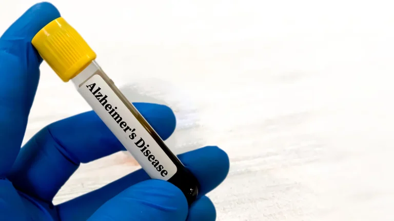 navigating-alzheimers-diagnostics-the-unseen-influence-of-renal-health-on-blood-biomarker-accuracy