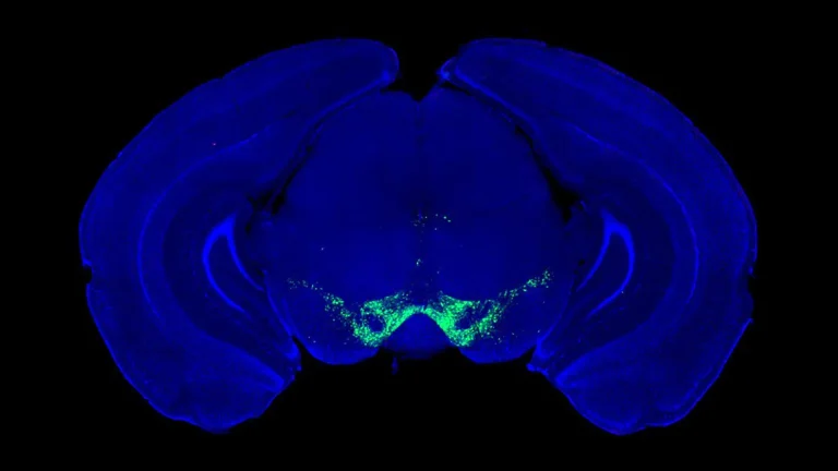 new-research-reframes-dopamines-foundational-role-in-motor-control-potentially-revolutionizing-parkinsons-therapeutics