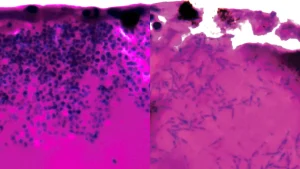 novel-genetic-insight-unlocks-potential-new-avenues-against-critically-dangerous-fungus