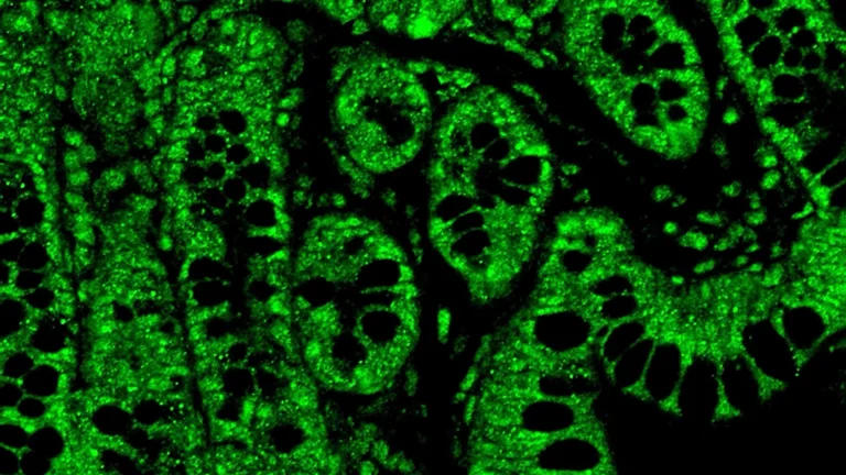 cannabis-compound-in-sub-perceptual-doses-may-revolutionize-hiv-management-by-mitigating-treatment-complications