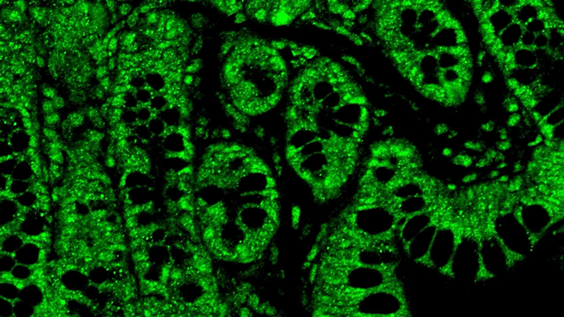 cannabis-compound-in-sub-perceptual-doses-may-revolutionize-hiv-management-by-mitigating-treatment-complications