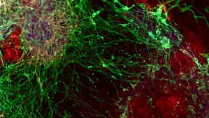 decoding-the-genetic-blueprint-of-neural-genesis-a-comprehensive-study-unveils-essential-genes-and-novel-disorder