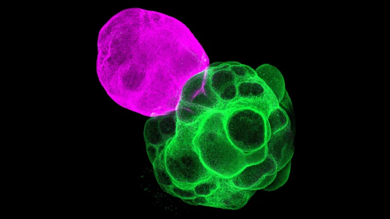 engineered-neural-hubs-illuminate-human-brain-circuitry-development