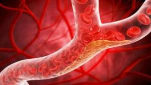 how-type-2-diabetes-quietly-damages-blood-vessels