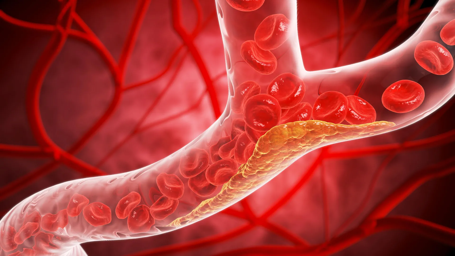 how-type-2-diabetes-quietly-damages-blood-vessels