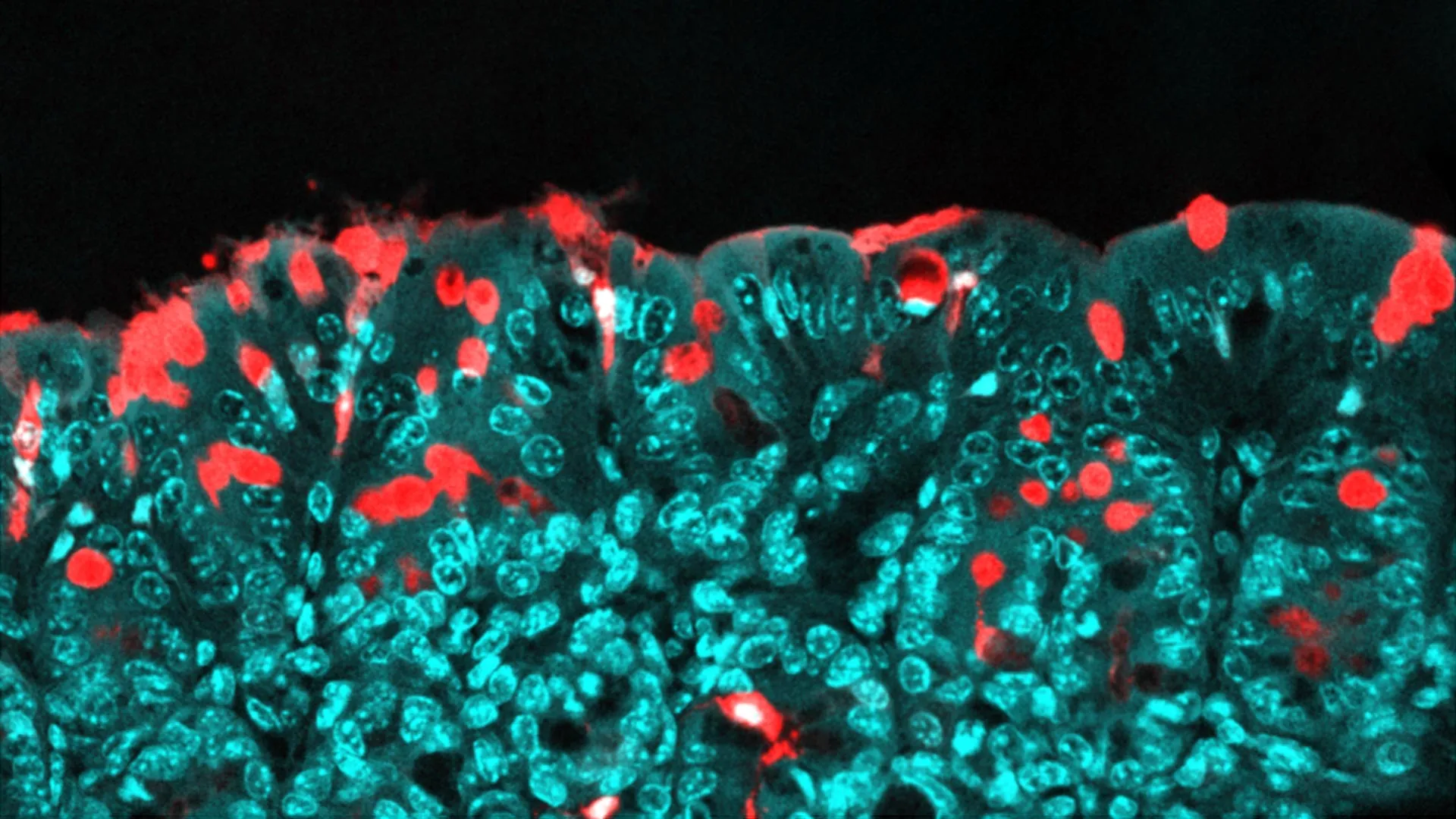 maternal-dietary-emulsifiers-implicated-in-altered-offspring-gut-development-and-long-term-disease-risk