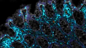 novel-immune-cell-strategy-promises-gut-regeneration-in-aging-and-injured-intestines