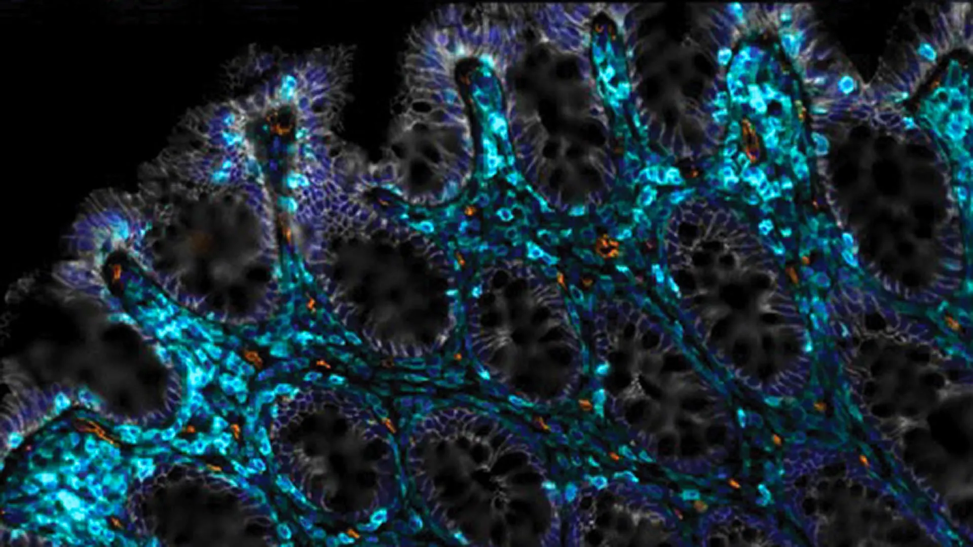 novel-immune-cell-strategy-promises-gut-regeneration-in-aging-and-injured-intestines