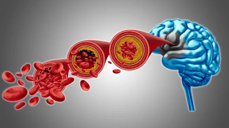 novel-molecular-pathway-identified-to-potentially-reverse-brain-blood-flow-deficits-in-dementia