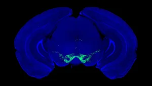 rethinking-dopamines-direct-command-over-motor-execution-new-research-redefines-parkinsons-disease-mechanisms