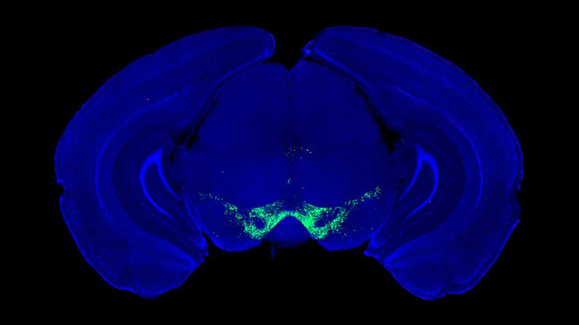rethinking-dopamines-direct-command-over-motor-execution-new-research-redefines-parkinsons-disease-mechanisms