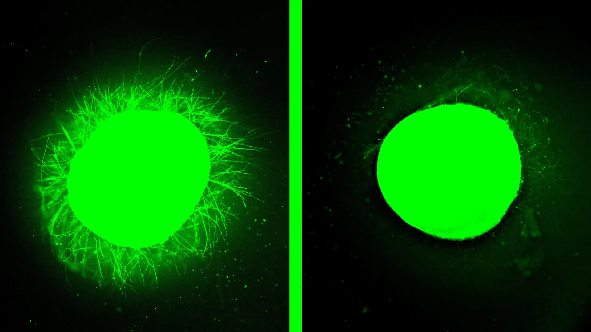 northwestern-develops-advanced-human-spinal-cord-model-demonstrating-nanotherapeutic-potential-for-injury-repair