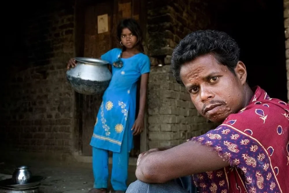 unveiling-the-hidden-scars-global-health-efforts-confront-mental-health-crisis-and-funding-gaps-in-neglected-tropical-diseases