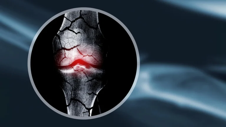 revolutionary-decellularized-cartilage-matrix-paves-way-for-universal-bone-regeneration-solutions