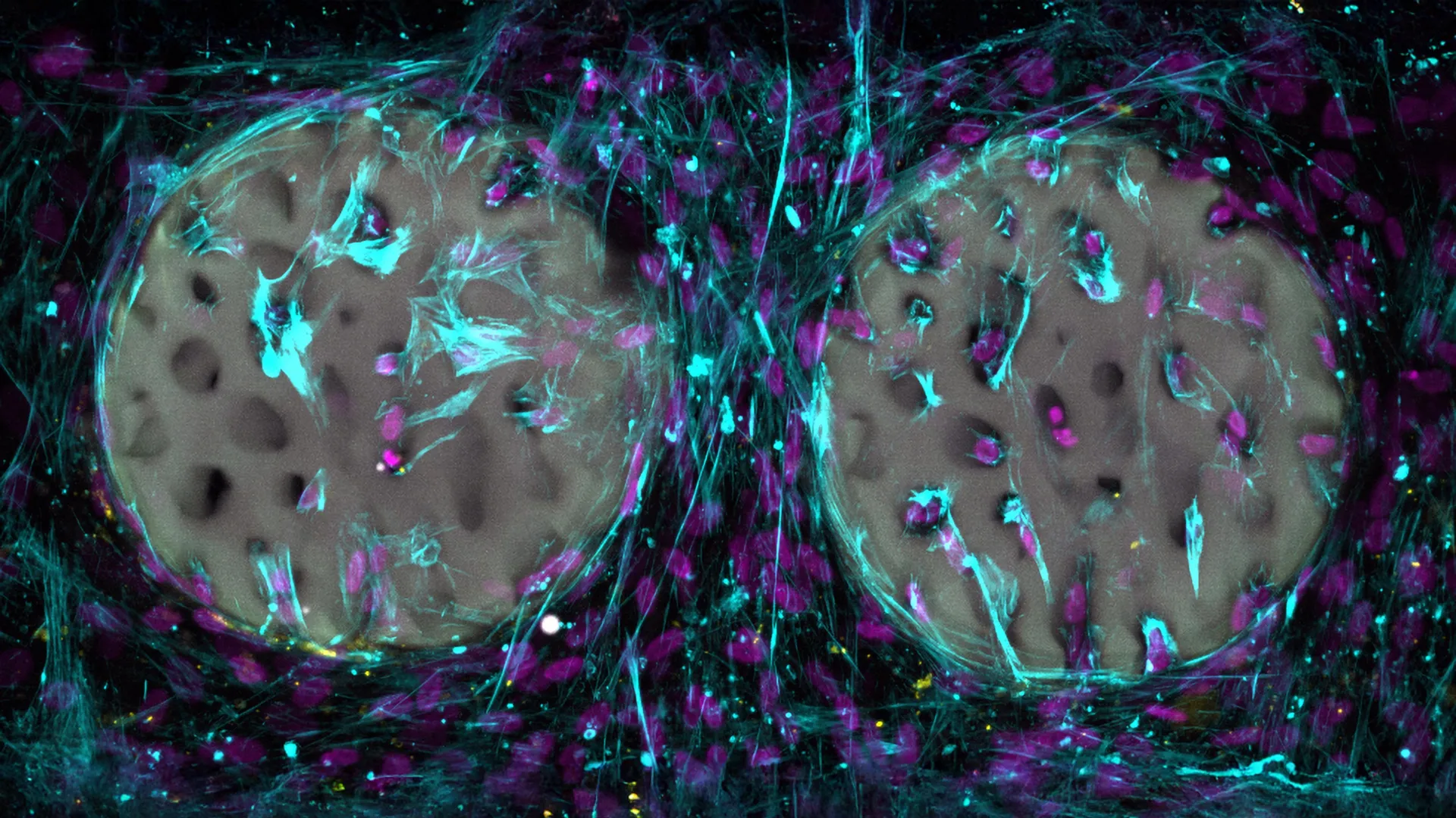 revolutionary-hydrogel-printing-paves-way-for-advanced-bone-regeneration-therapies