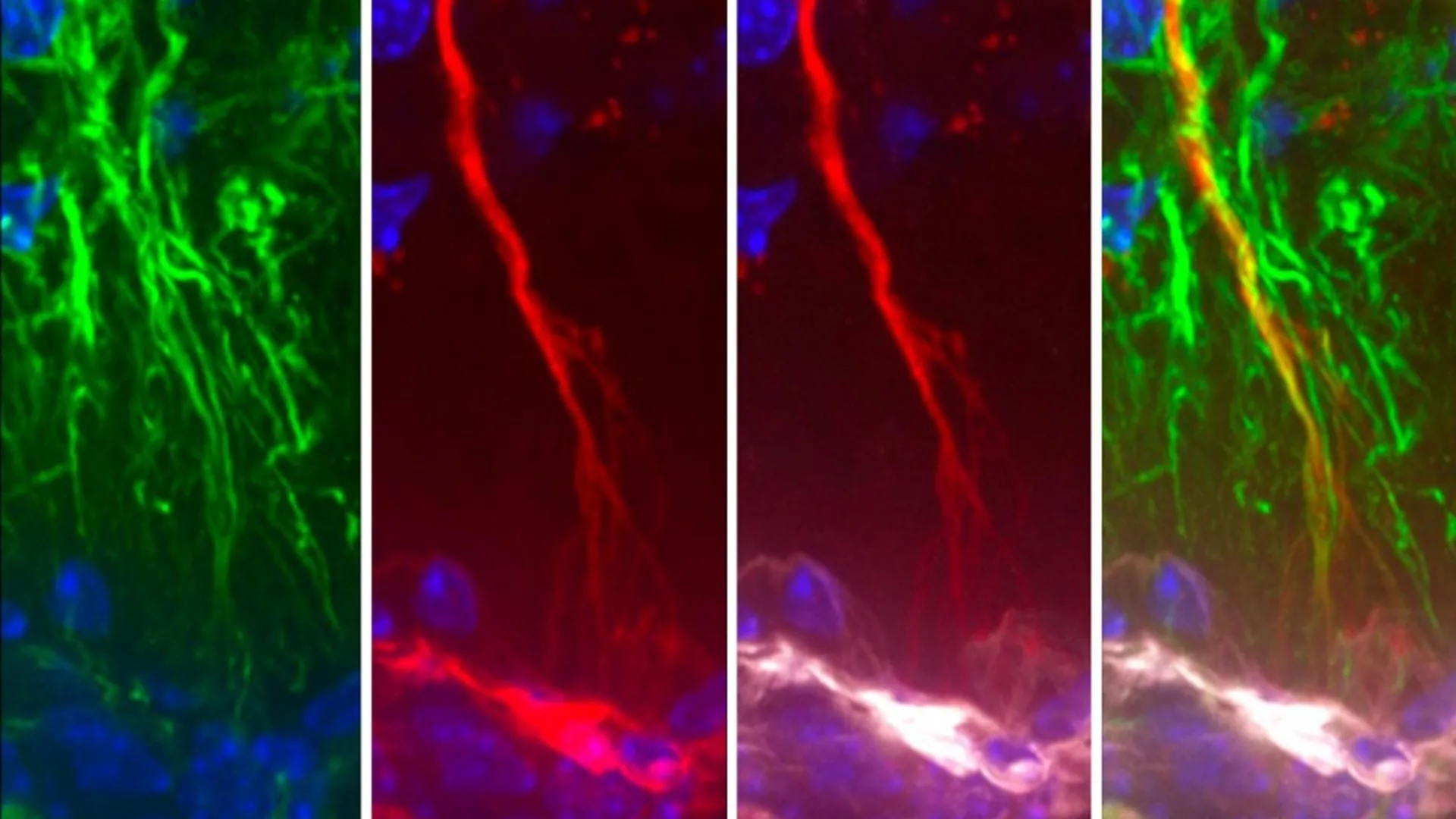 scientists-discover-hidden-brain-cells-that-may-stop-alzheimers-tau-buildup