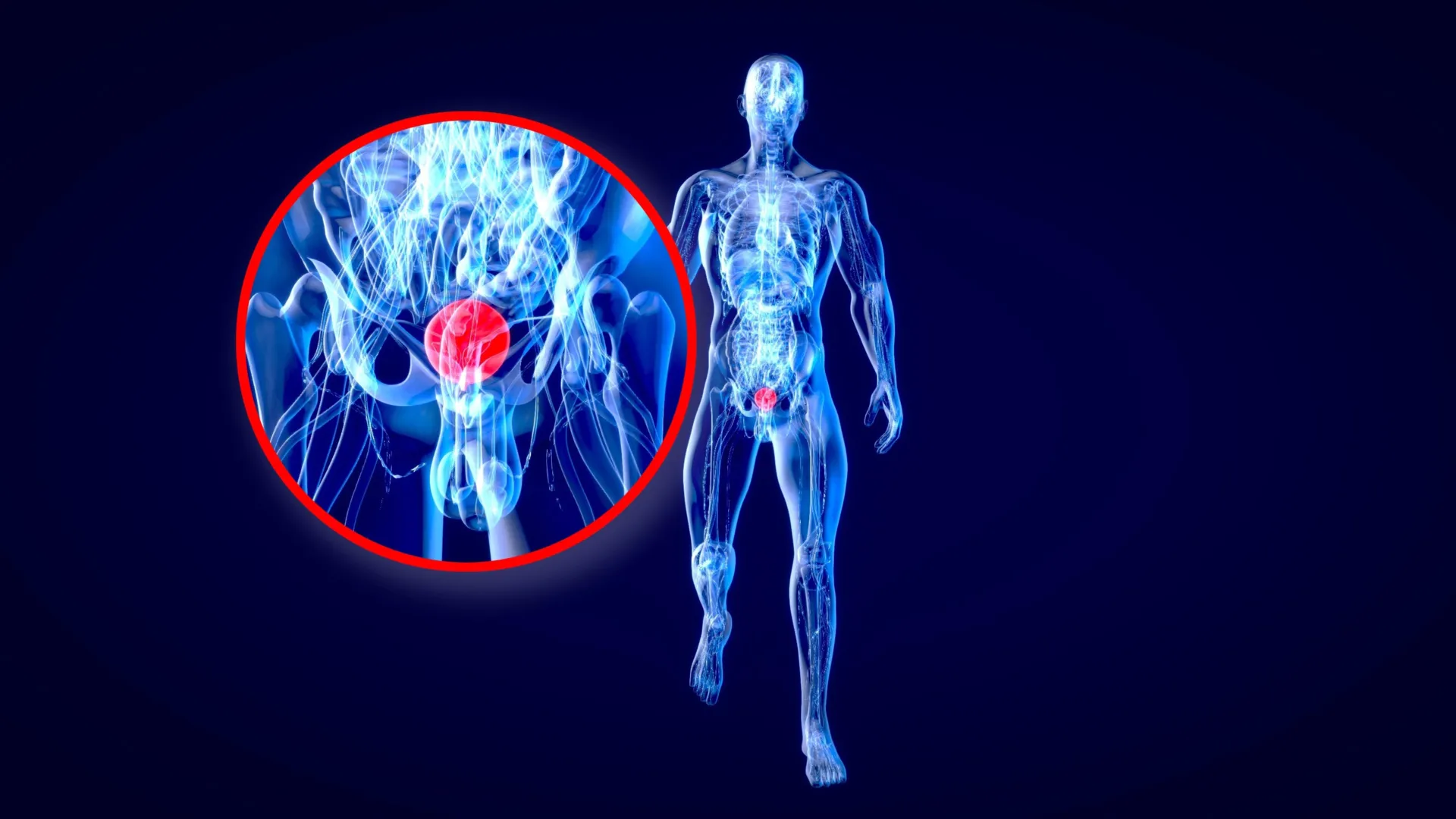 unseen-symptom-how-color-vision-deficiency-elevates-bladder-cancer-mortality-risk