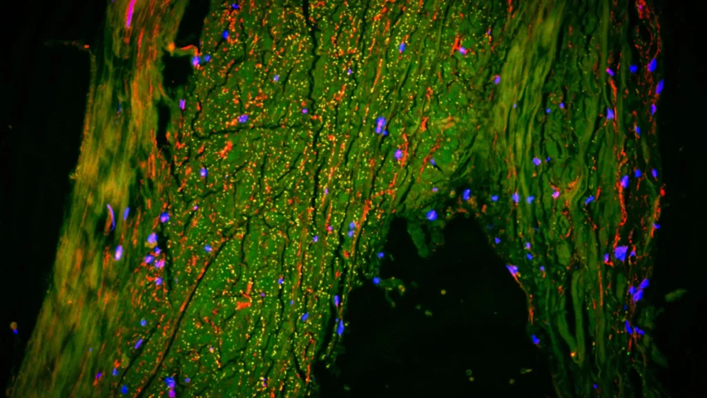 cerebral-waste-clearance-new-insights-reveal-arterial-pathways-role-in-brain-lymphatic-function
