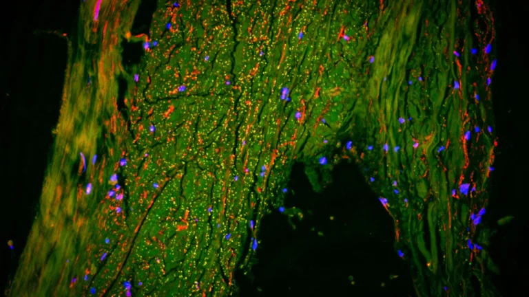 cerebral-waste-clearance-new-insights-reveal-arterial-pathways-role-in-brain-lymphatic-function