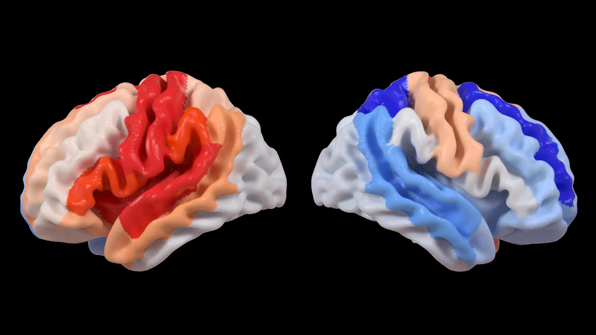 novel-neural-reorganization-after-stroke-mimics-youthful-brain-states-in-unaffected-hemispheres