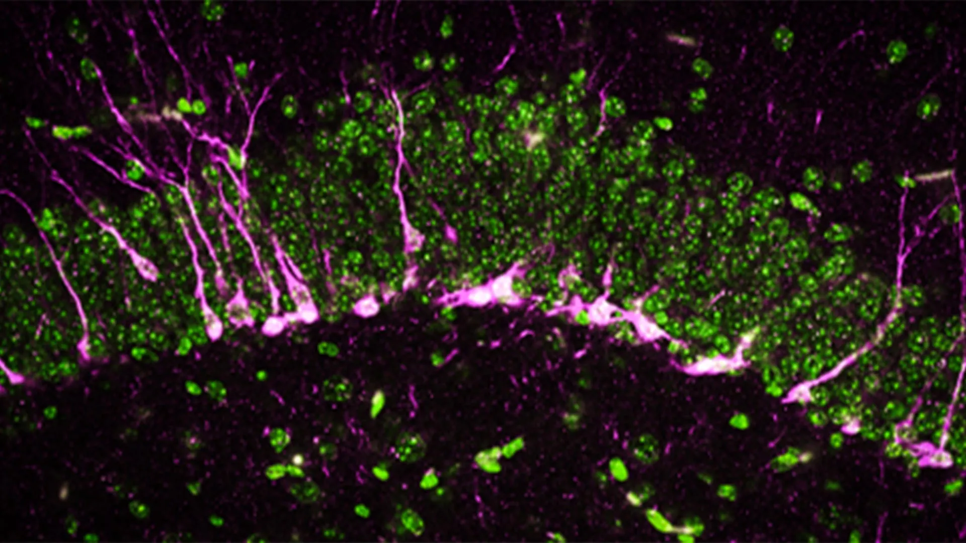 novel-protein-pathway-emerges-as-potential-target-for-alzheimers-intervention