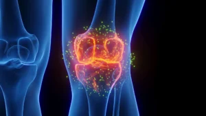 acoustic-modulation-of-immune-cells-offers-novel-therapeutic-avenue-for-joint-injury-and-osteoarthritis-prevention