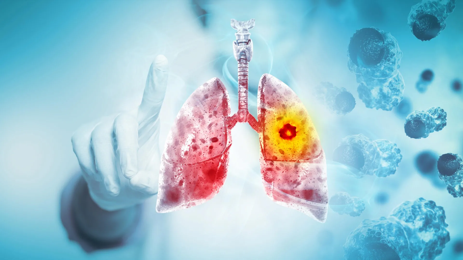 diet-environment-and-disease-unveiling-new-insights-into-early-onset-lung-cancer-risk