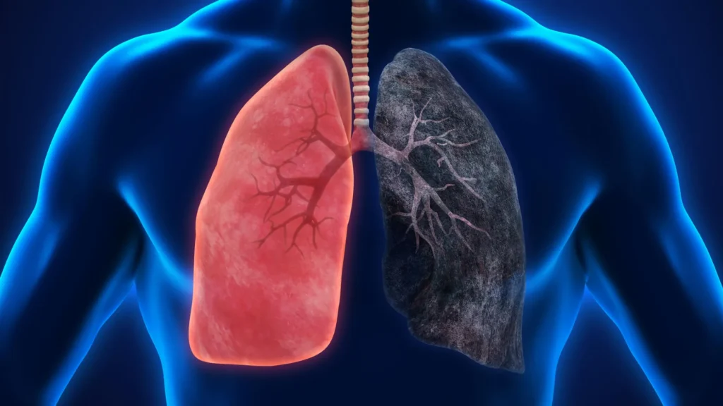 emerging-research-uncovers-potential-carcinogenic-links-in-frequent-cannabis-inhalation