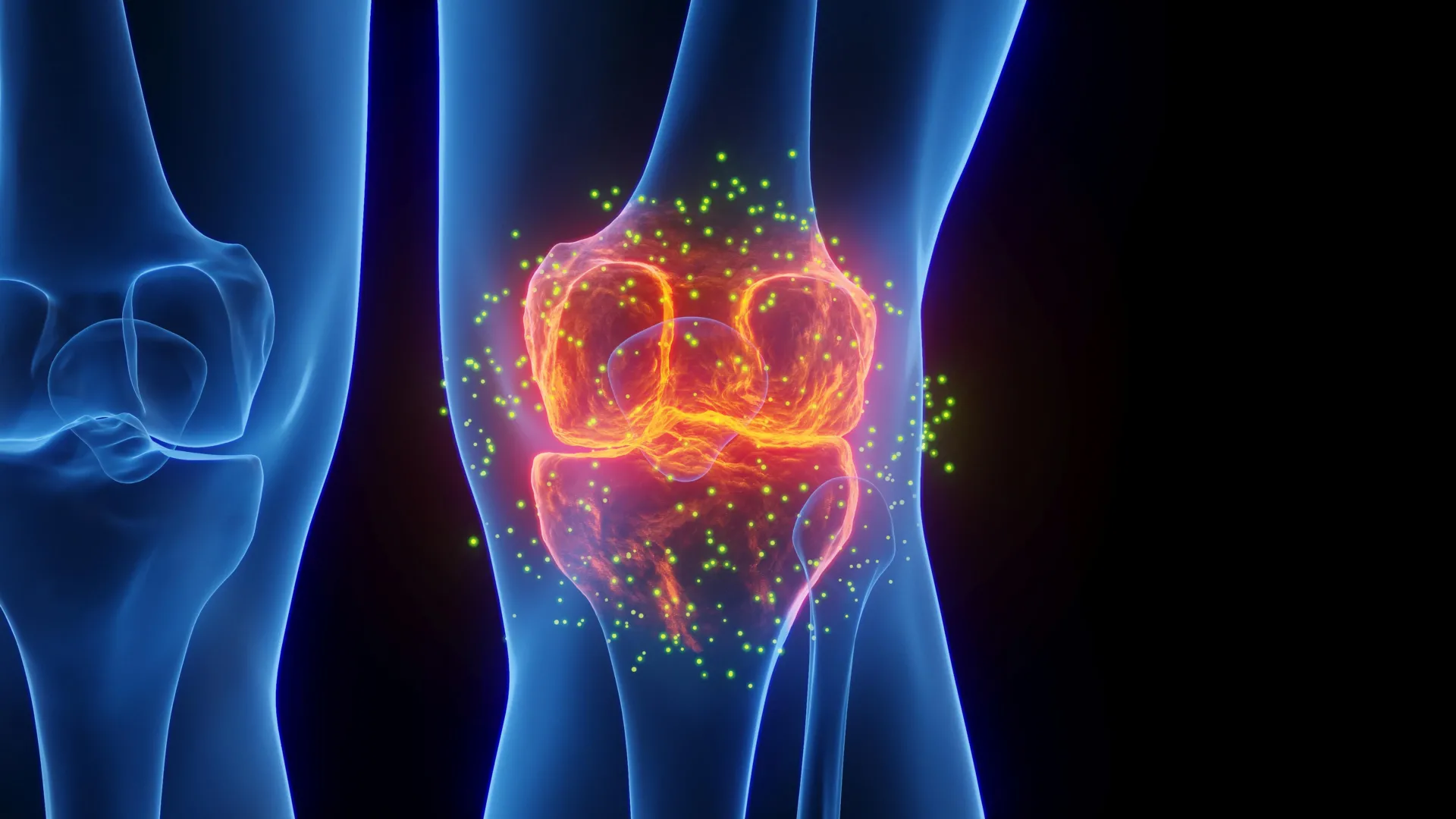innovating-non-invasive-ultrasound-application-a-paradigm-shift-in-preemptive-arthritis-mitigation-and-enhanced-tissue-regeneration