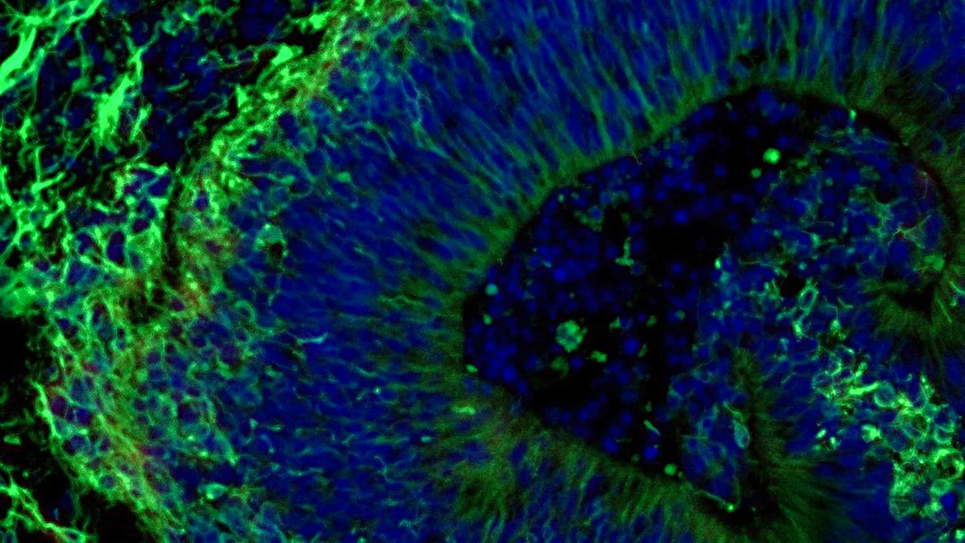 novel-brain-tissue-models-offer-clues-to-tailoring-alzheimers-therapies