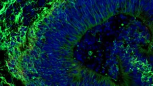 patient-specific-brain-organoids-show-promise-for-predicting-alzheimers-therapeutic-efficacy