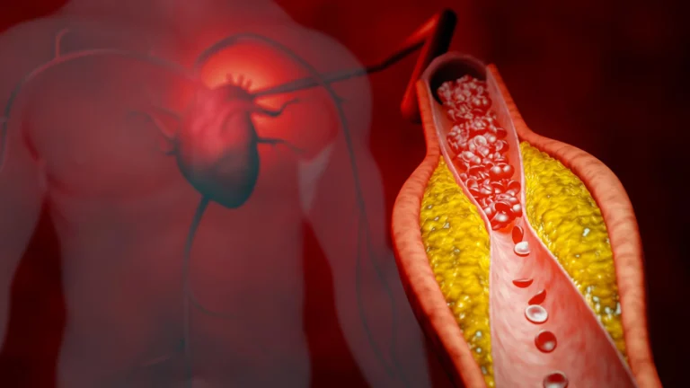 precision-in-prevention-new-research-advocates-for-apolipoprotein-b-as-a-superior-cardiovascular-risk-marker