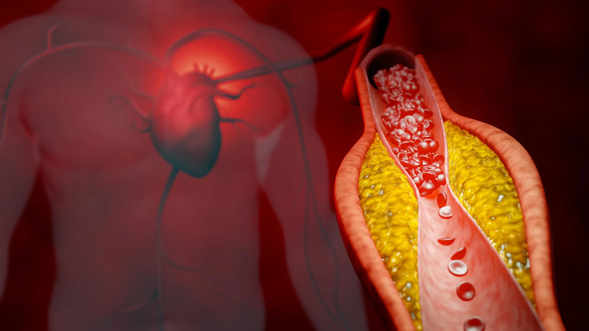 precision-in-prevention-new-research-advocates-for-apolipoprotein-b-as-a-superior-cardiovascular-risk-marker