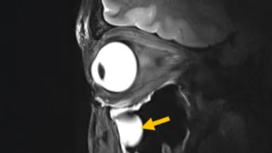 revolutionary-metamaterial-antenna-unlocks-unprecedented-clarity-in-deep-brain-and-ocular-magnetic-resonance-imaging