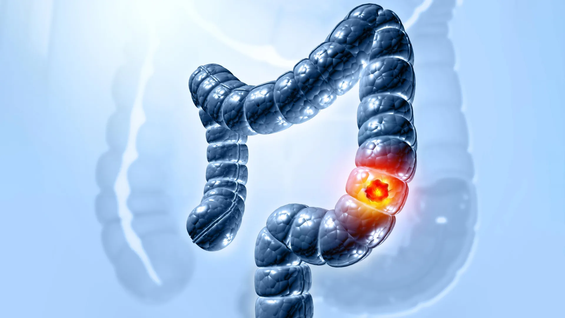 unraveling-the-molecular-gateway-how-a-prevalent-gut-microbes-toxin-infiltrates-colon-cells-to-drive-cancerous-transformations