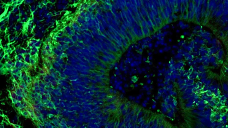advanced-brain-organoids-offer-predictive-power-for-alzheimers-treatment-efficacy