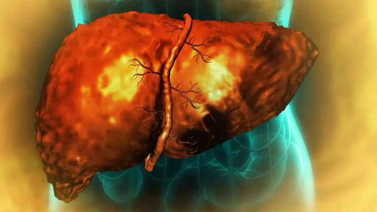 cellular-stasis-revealed-chronic-inflammation-hinders-livers-innate-healing-capacity-post-alcohol-cessation