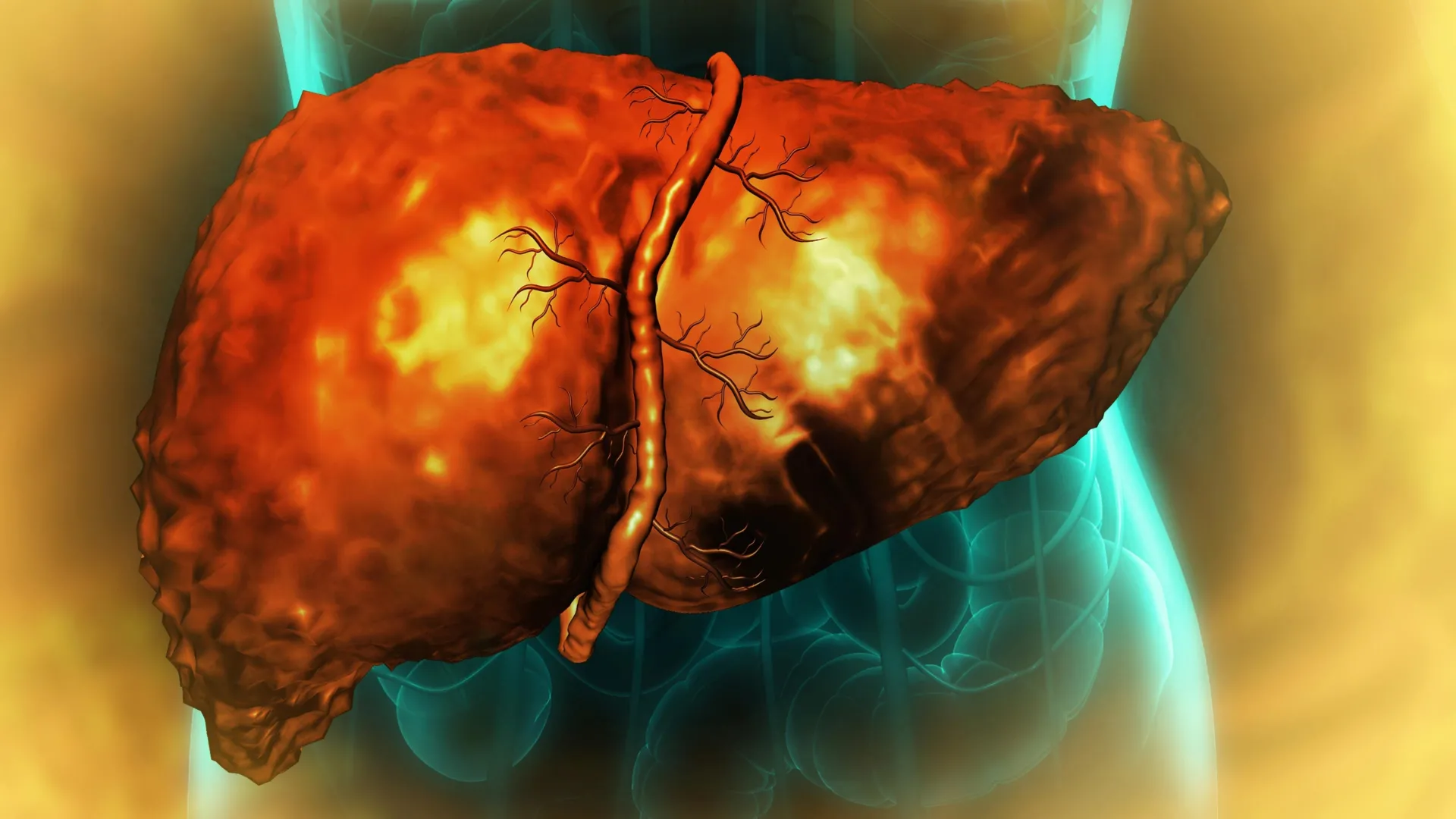 cellular-stasis-revealed-chronic-inflammation-hinders-livers-innate-healing-capacity-post-alcohol-cessation