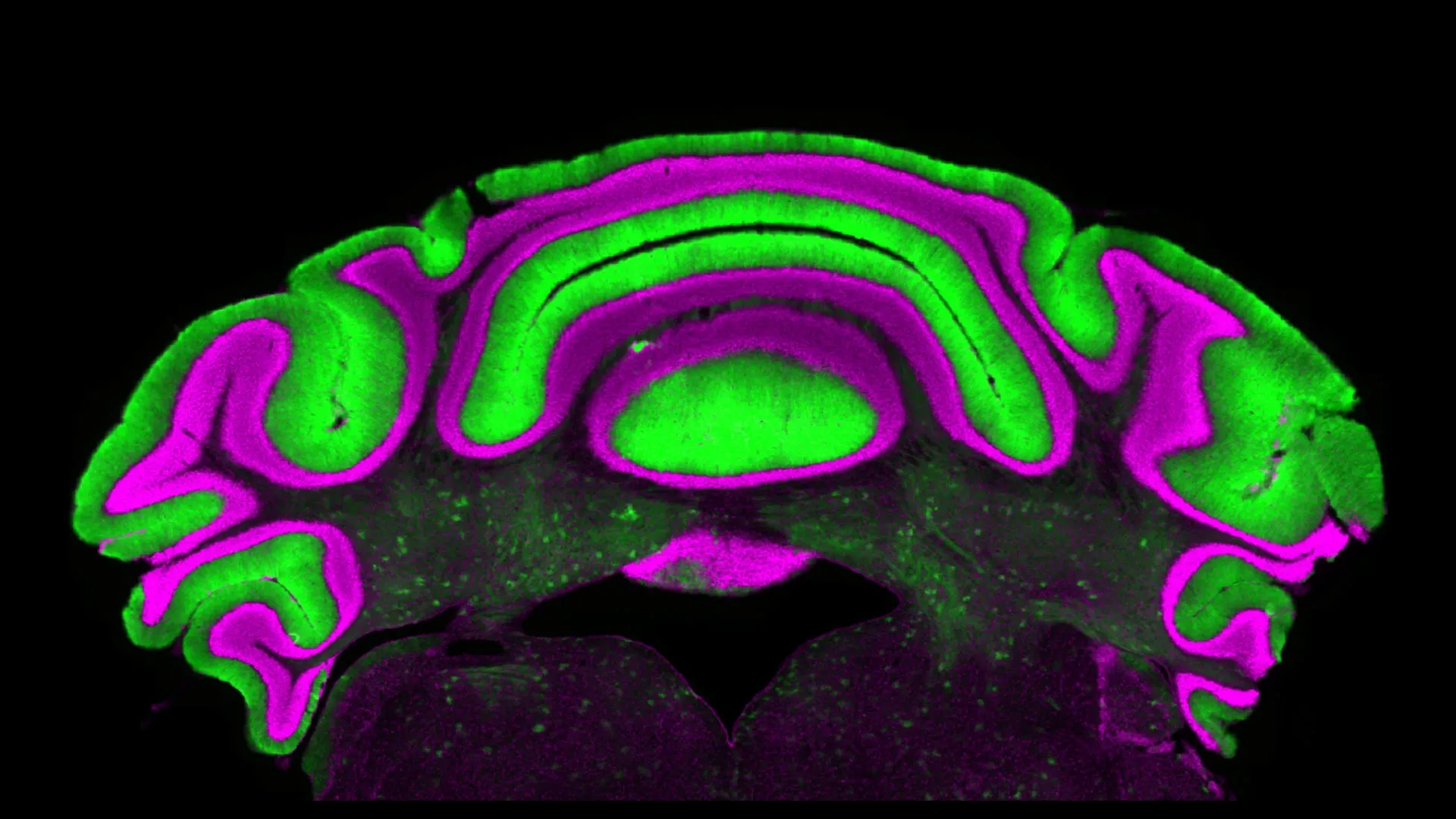 cerebellar-cell-activity-new-study-challenges-established-assumptions-in-movement-disorder-research