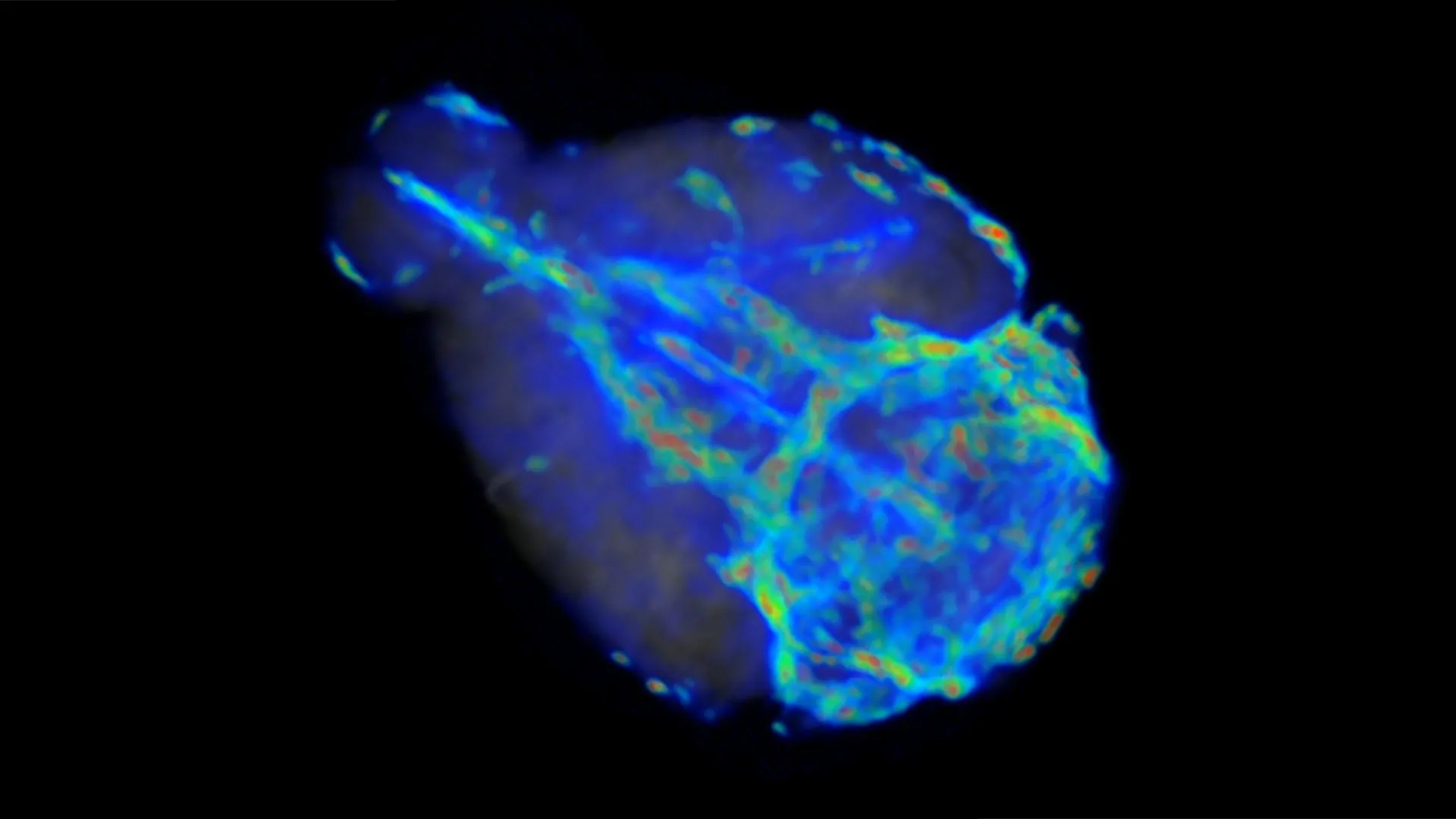 cerebral-waste-clearance-system-operates-at-dual-velocities-new-ai-driven-analysis-reveals