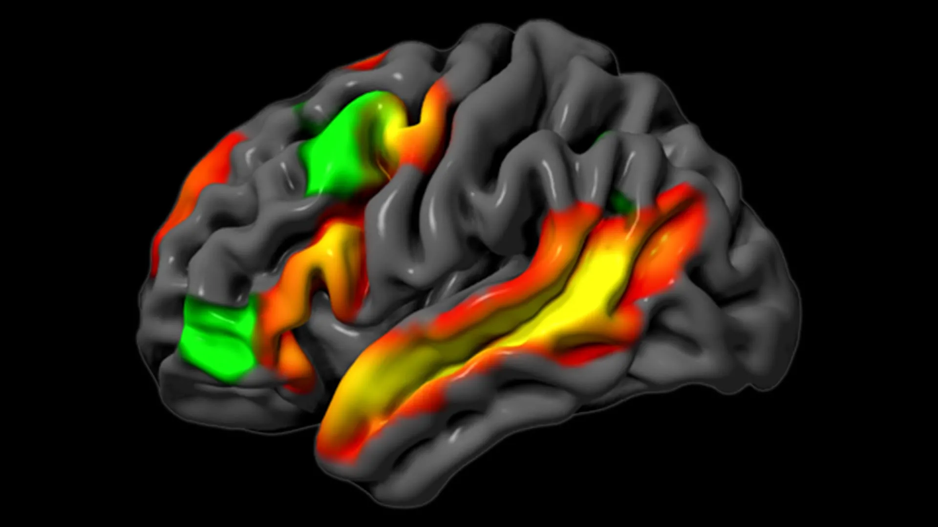 cognitive-neuroscience-unveils-independent-pathways-for-logic-and-language-in-the-human-brain