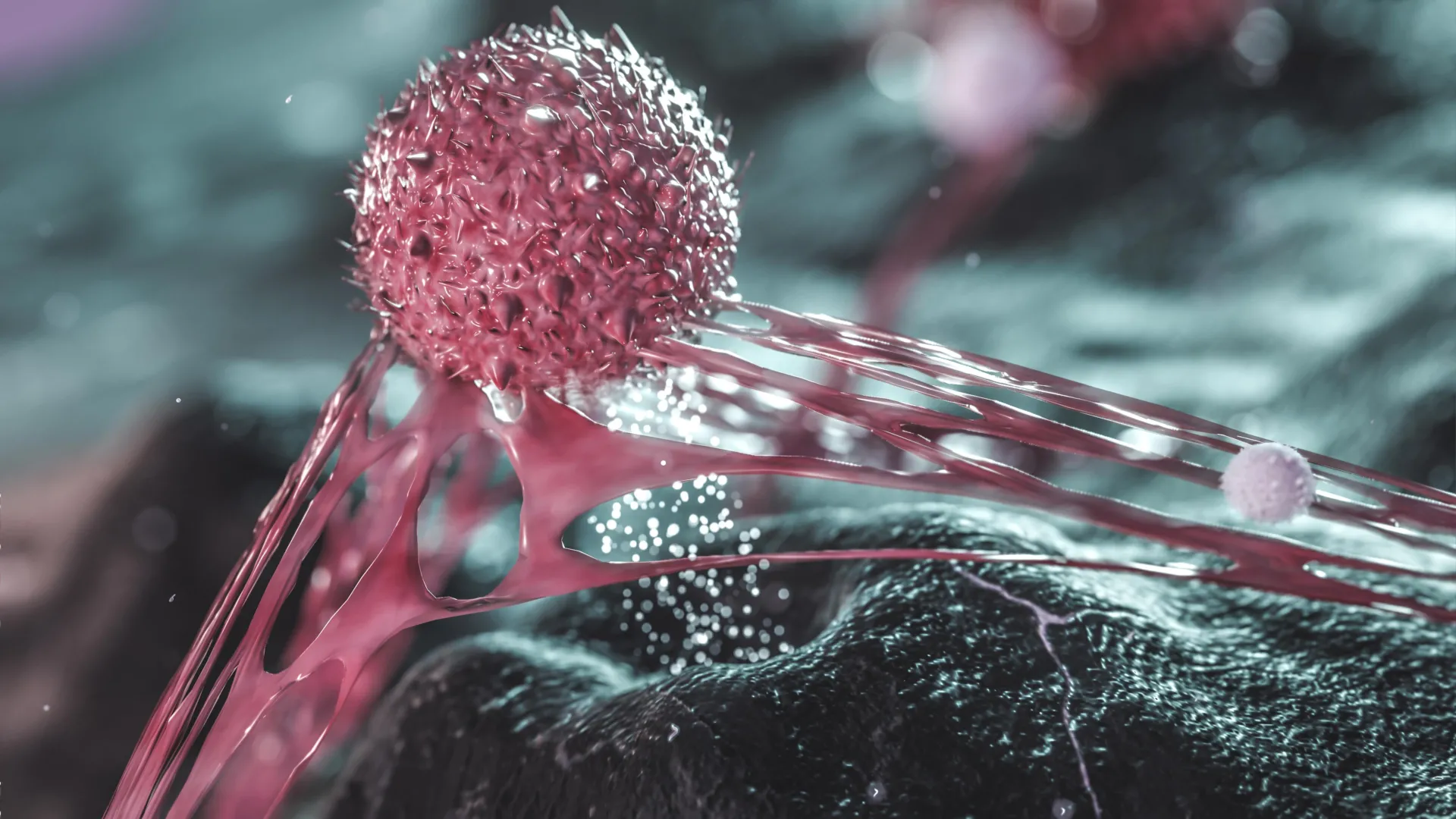 dietary-sugar-metabolite-facilitates-aggressive-cancer-dissemination-in-preclinical-models