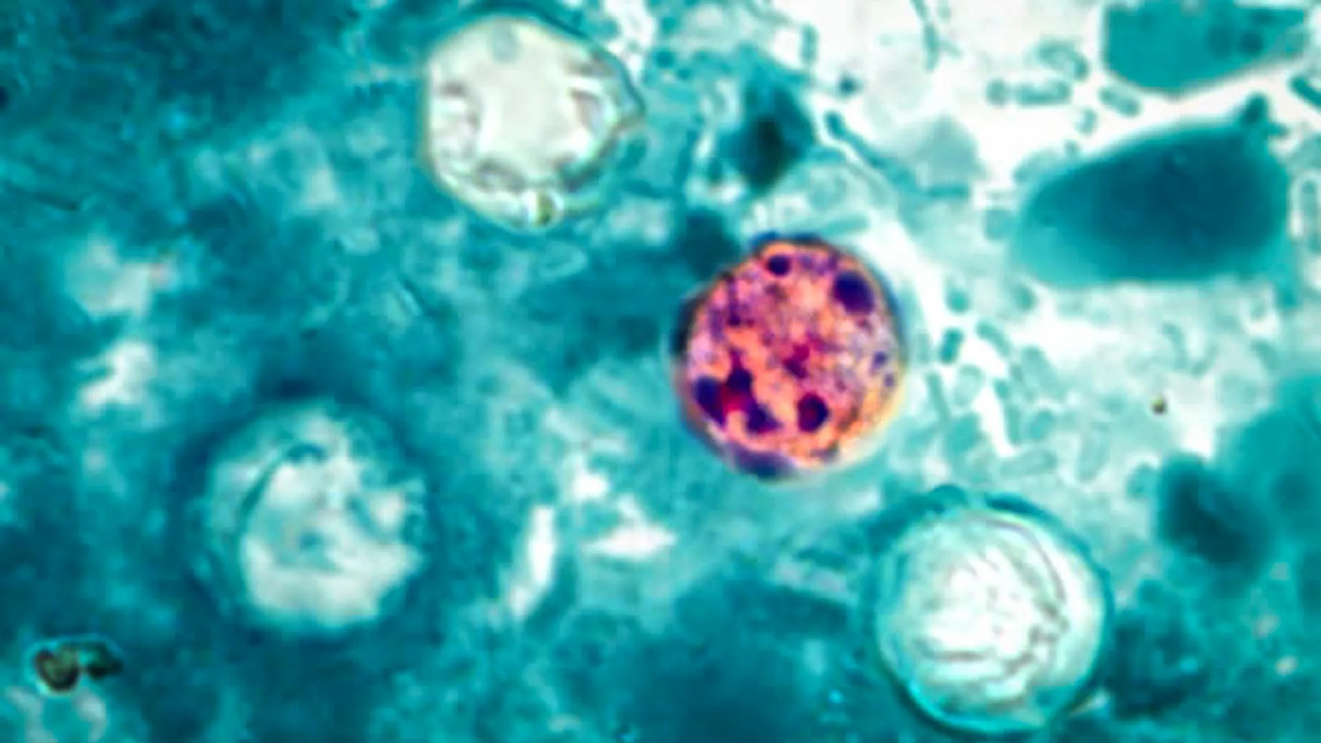 federal-health-watchdogs-mobilize-amidst-escalating-cyclosporiasis-incidents