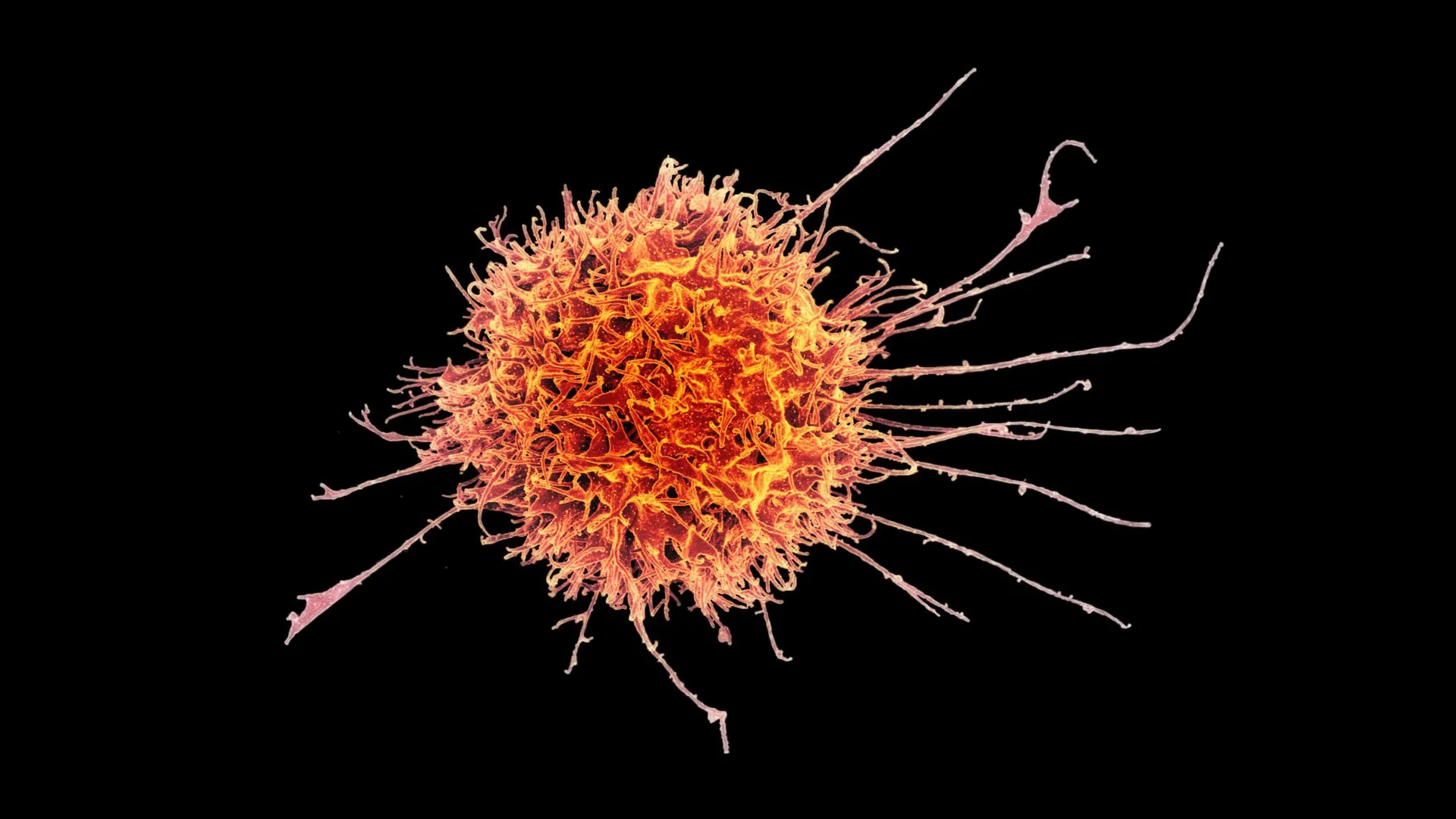 harnessing-innate-immunity-engineered-natural-killer-cells-offer-novel-strategy-against-solid-tumors