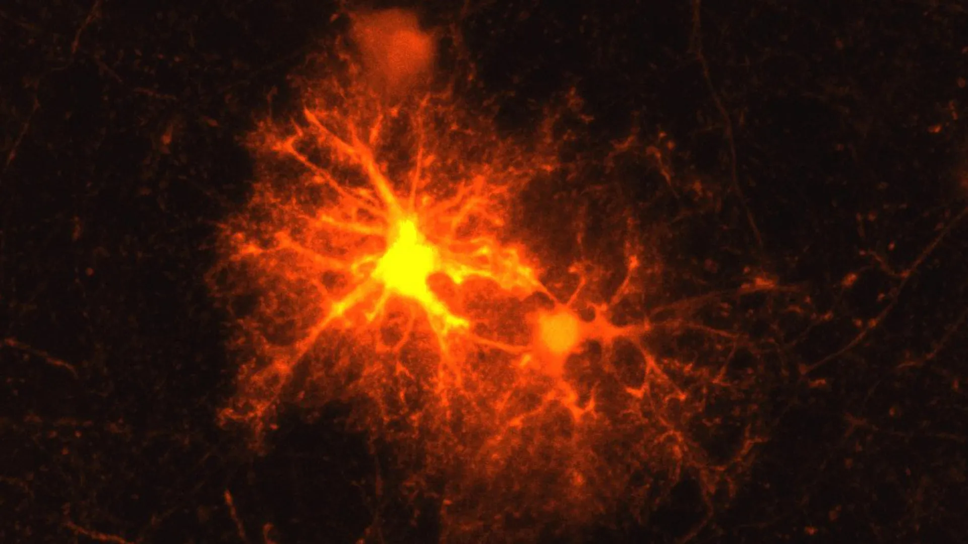 neural-precursors-respond-to-stress-signals-unlocking-brain-repair-and-development-insights