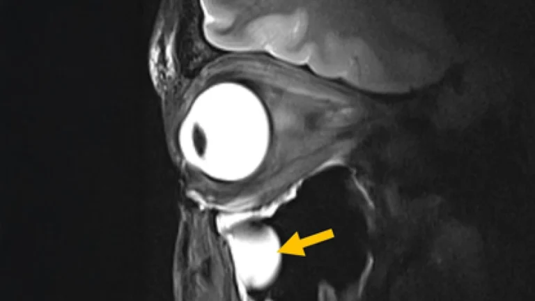 new-mri-breakthrough-reveals-the-brain-and-eye-like-never-before