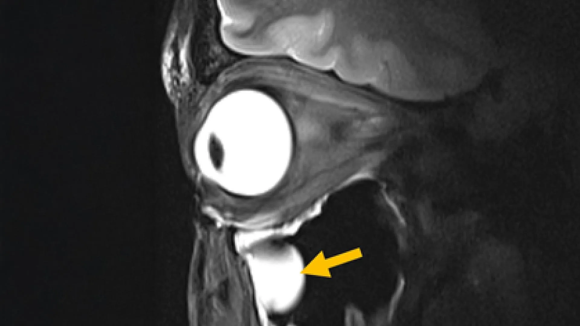 new-mri-breakthrough-reveals-the-brain-and-eye-like-never-before