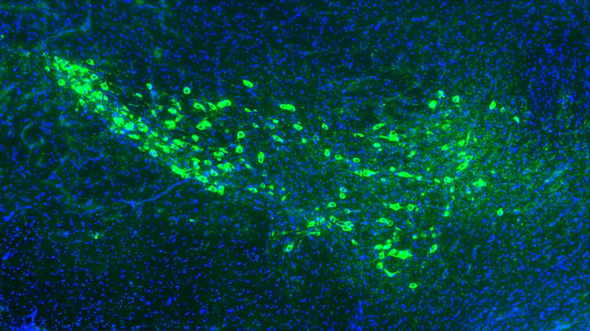 novel-insight-unveils-potential-pathways-for-halting-parkinsons-neuropathological-cascade