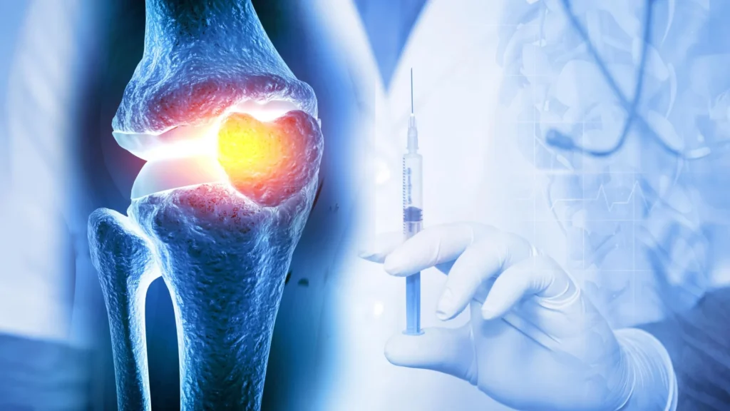sustained-intra-articular-drug-delivery-a-novel-hydrogel-system-targets-chronic-joint-disease