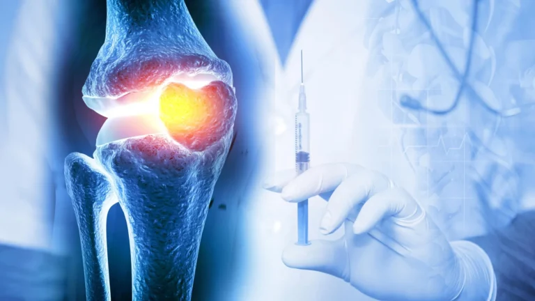 sustained-intra-articular-drug-delivery-a-novel-hydrogel-system-targets-chronic-joint-disease
